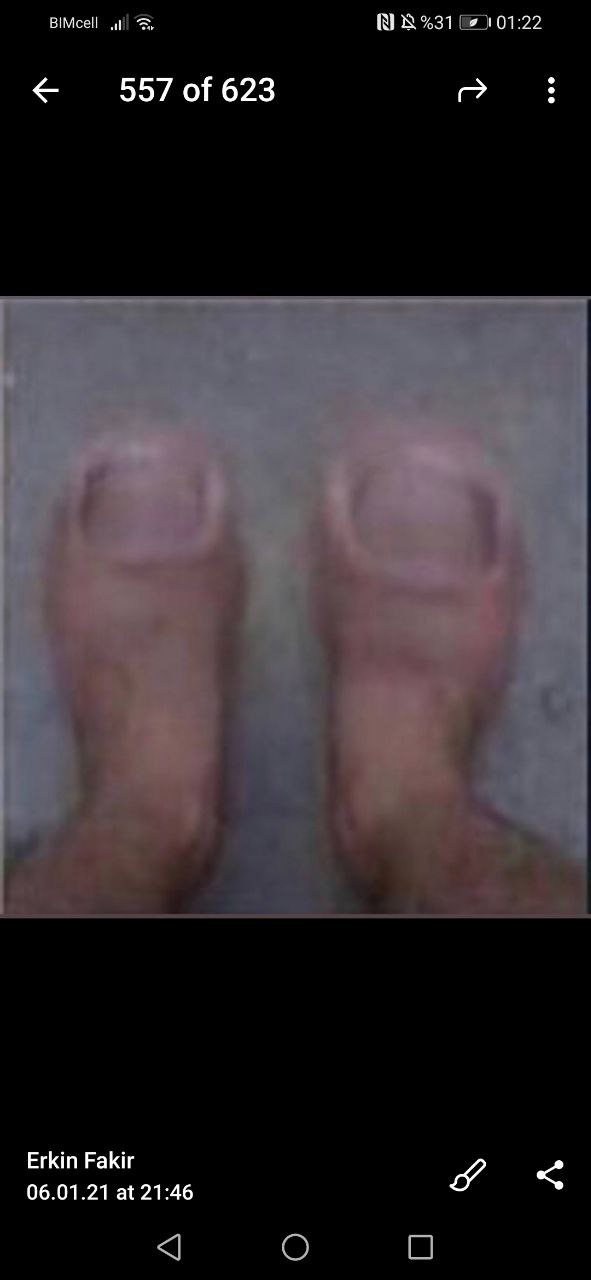 Turkish Slut Womans 22 arsivizm gallery