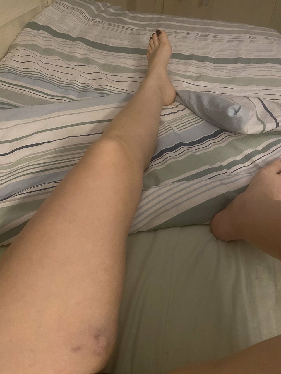 Turkish Slut Womans 28 arsivizm gallery