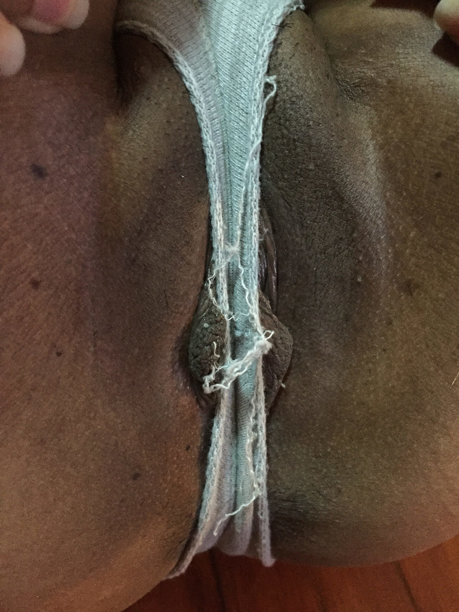 Pattay Filipina vs. Norwegian Stud