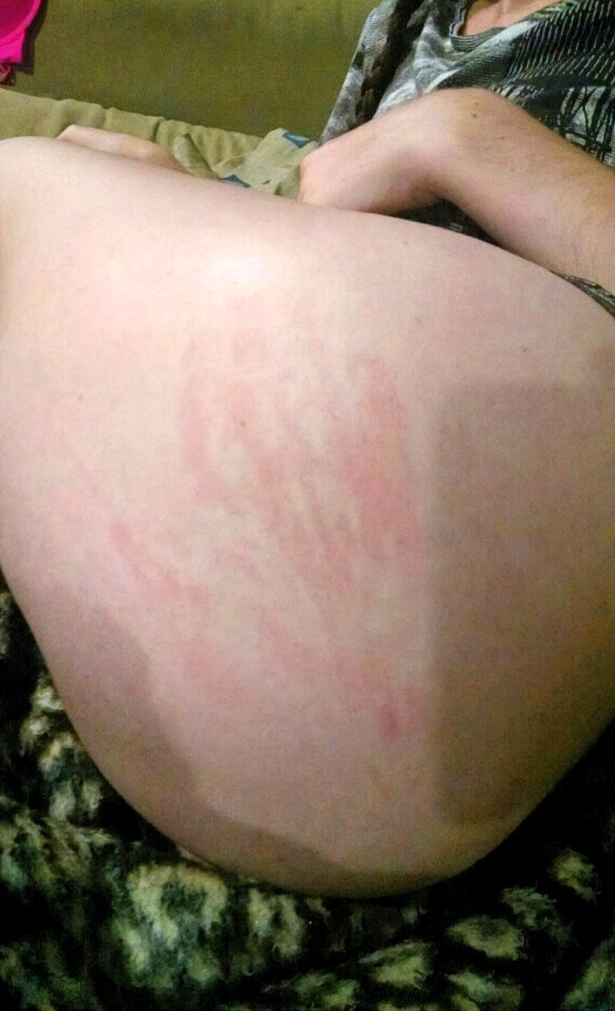 Likes To Feel Pain Redhead