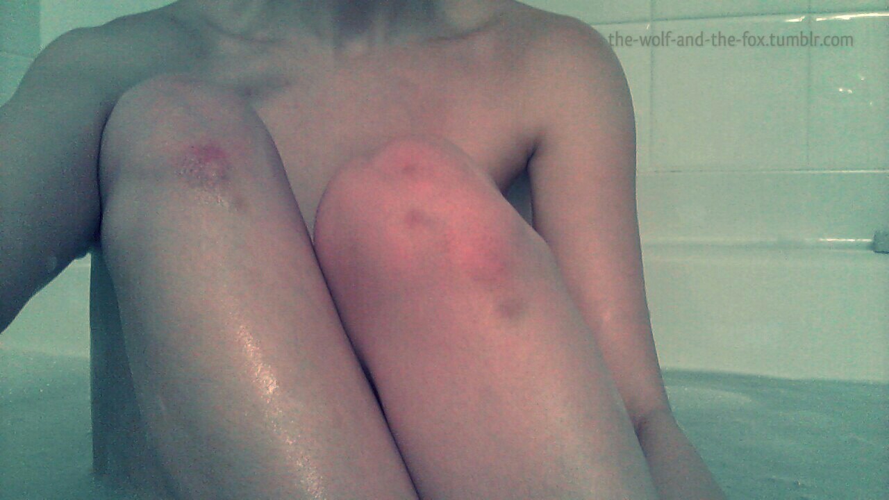 The Wolf and The Fox