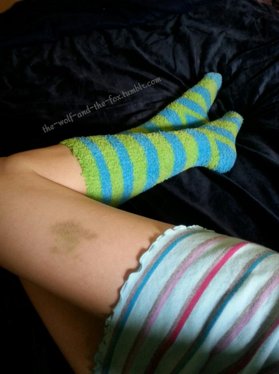 The Wolf and The Fox