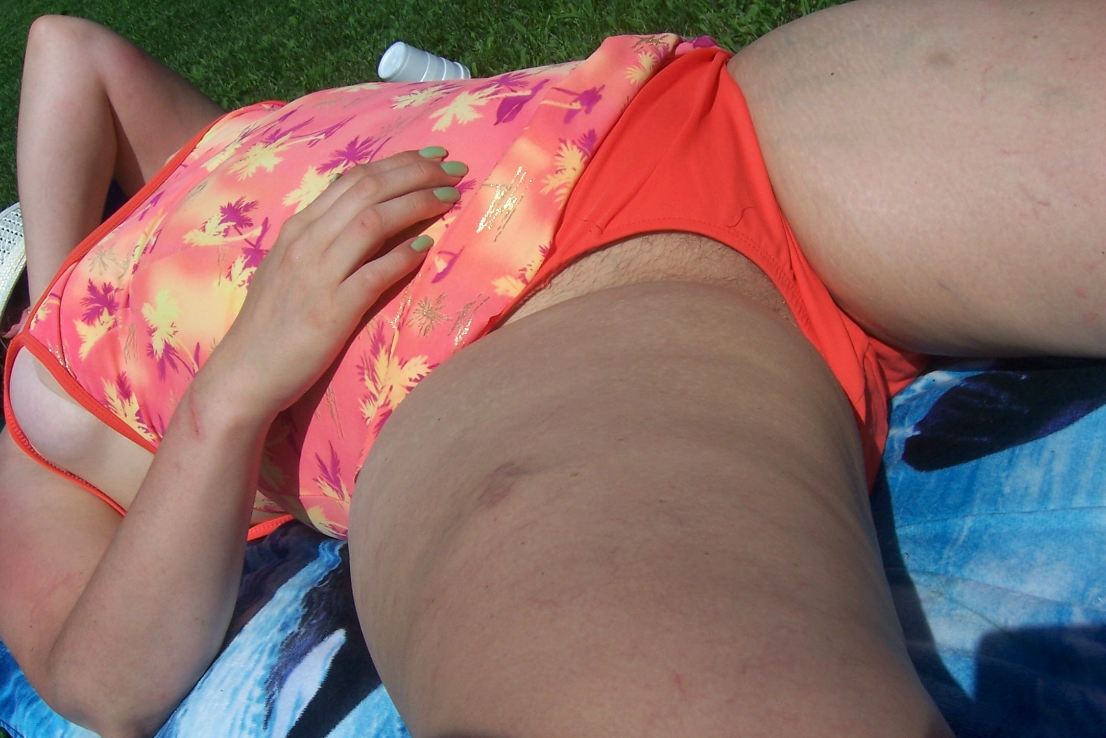 Bathing Suit Mishaps