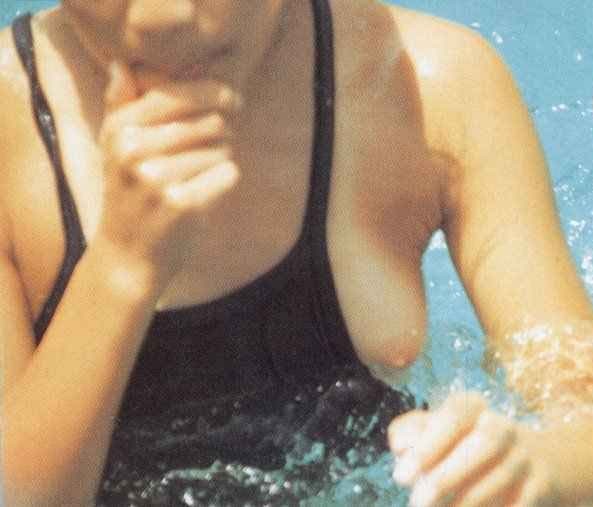 Bathing Suit Mishaps