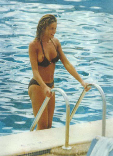 Bathing Suit Mishaps