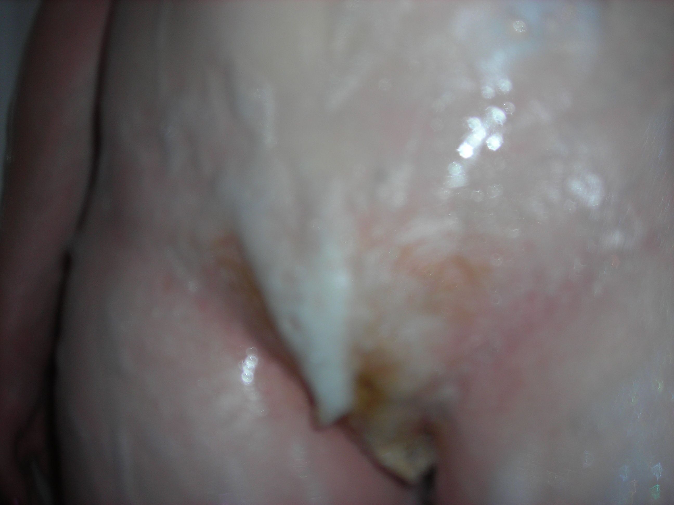 Red on The Head Fire in the Hole