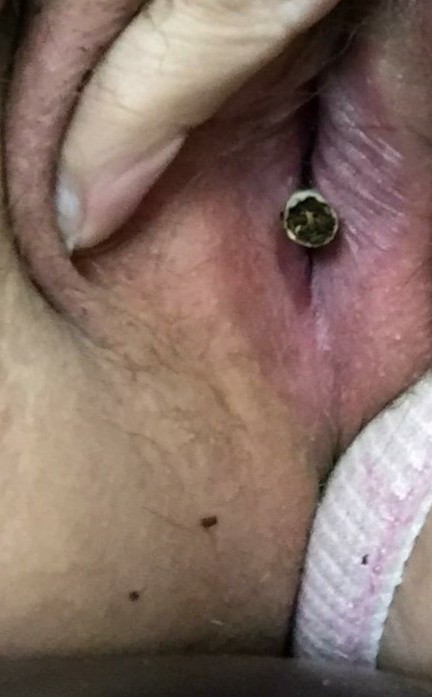 Hope Rene Yates DOB 04. 06. 1994. SW Indiana 46787.