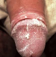 For passionate cock and cum lovers