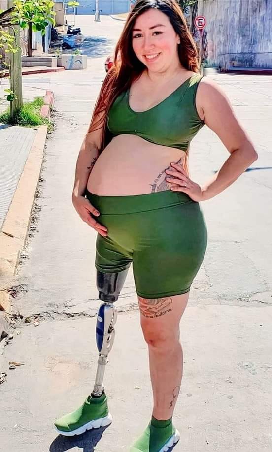 sexy disabled women