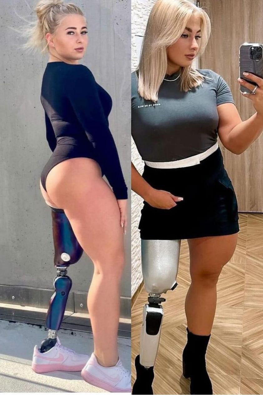 sexy disabled women