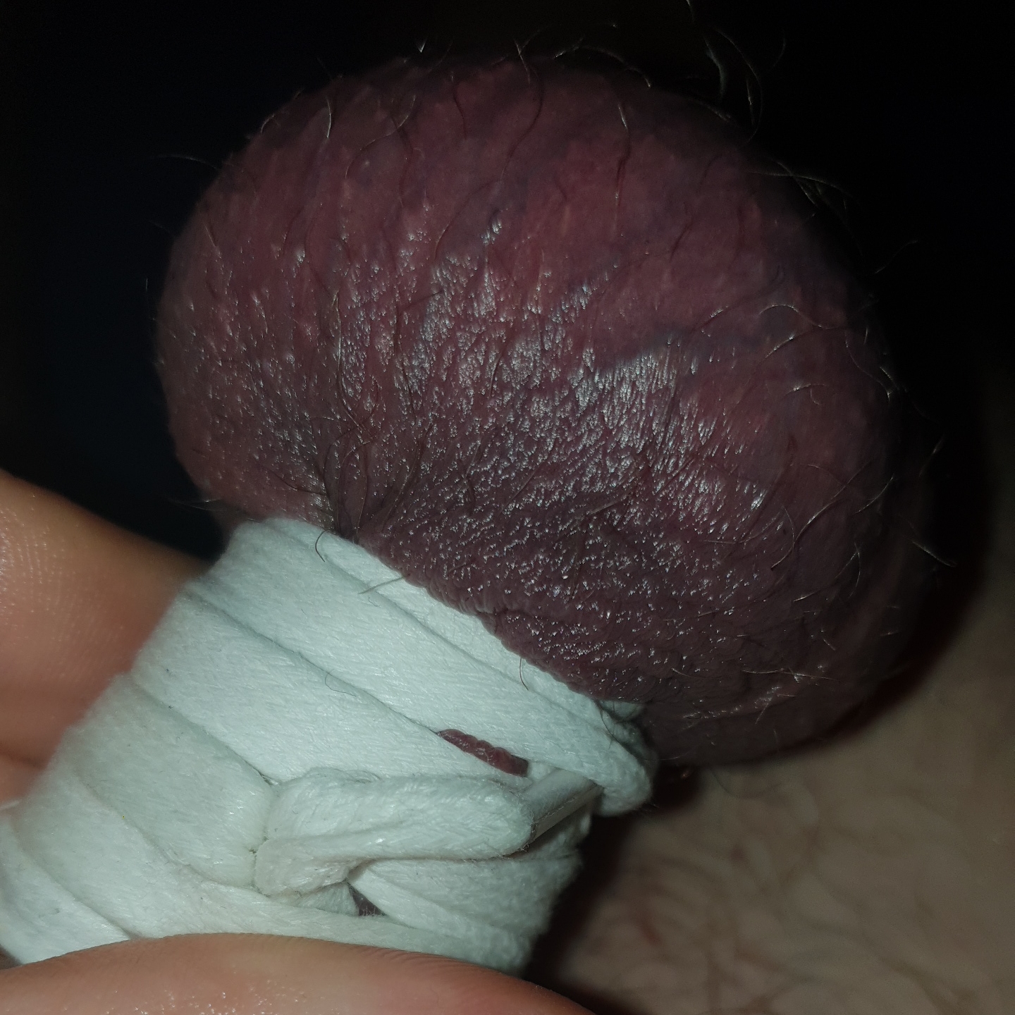 CBT cock and ball tourter