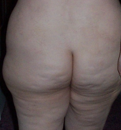 Tracey Stoute-Greene SSBBW Bajan Whore