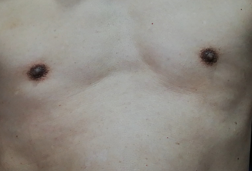 Holly thorns stimulate nipples and penis