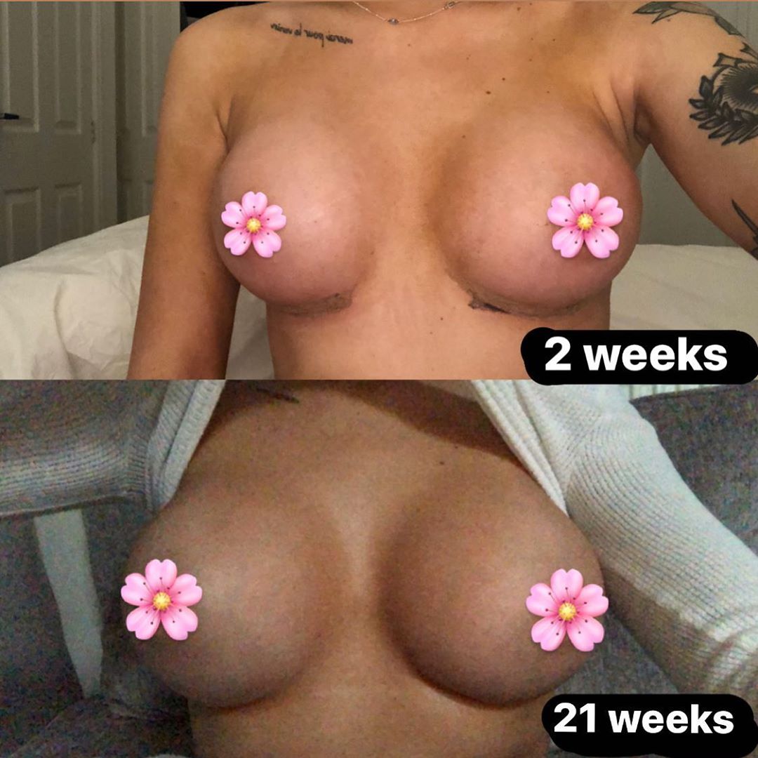 Liv.Jenkins Enhanced 2