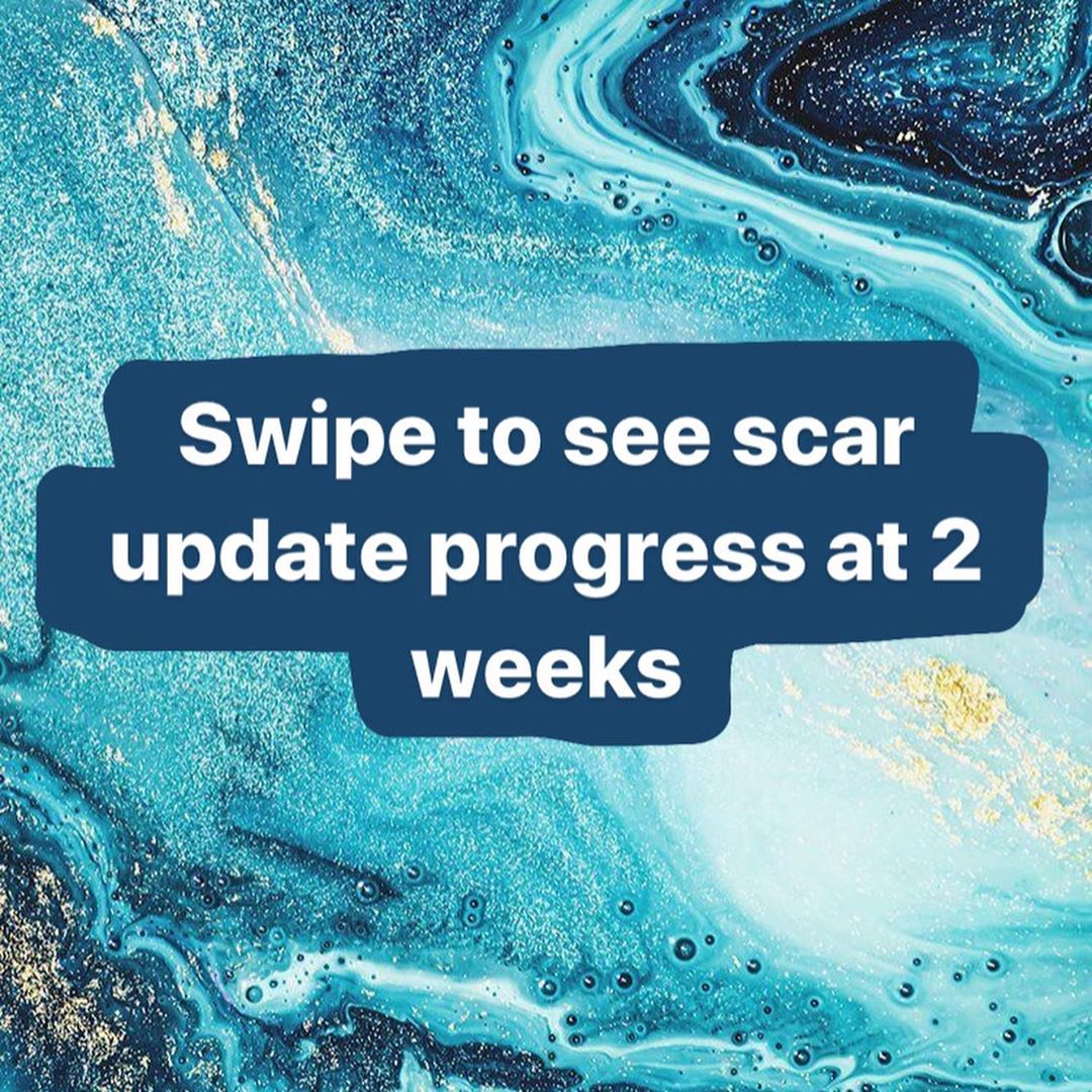 Liv.Jenkins Enhanced 2