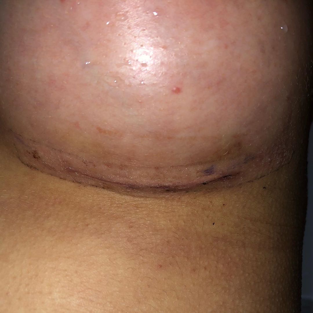 Liv.Jenkins Enhanced 2