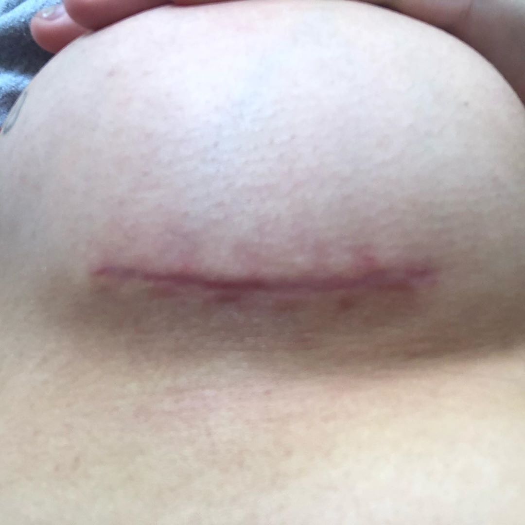 Liv.Jenkins Enhanced 2