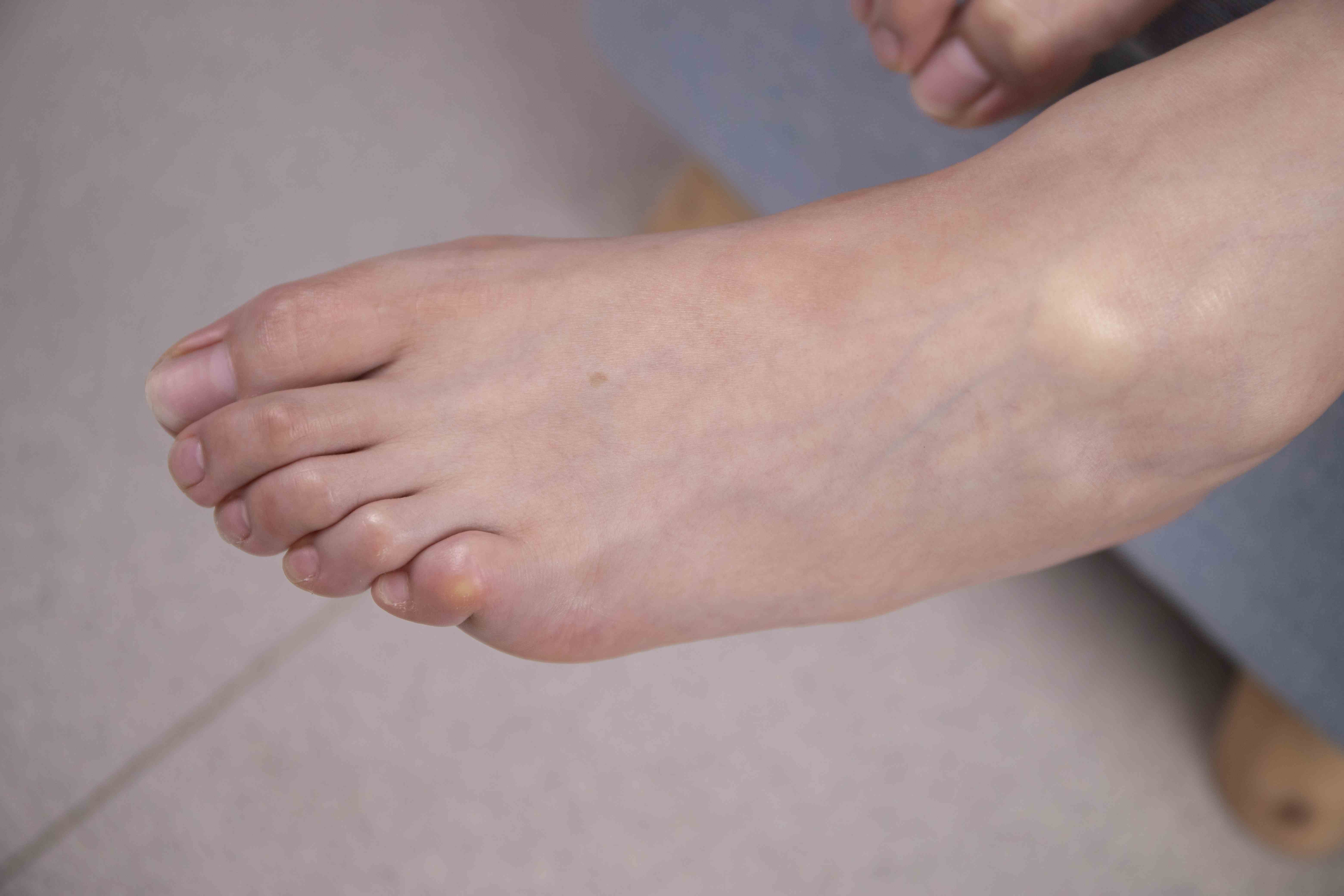 China Beauty Legs and feet 1550