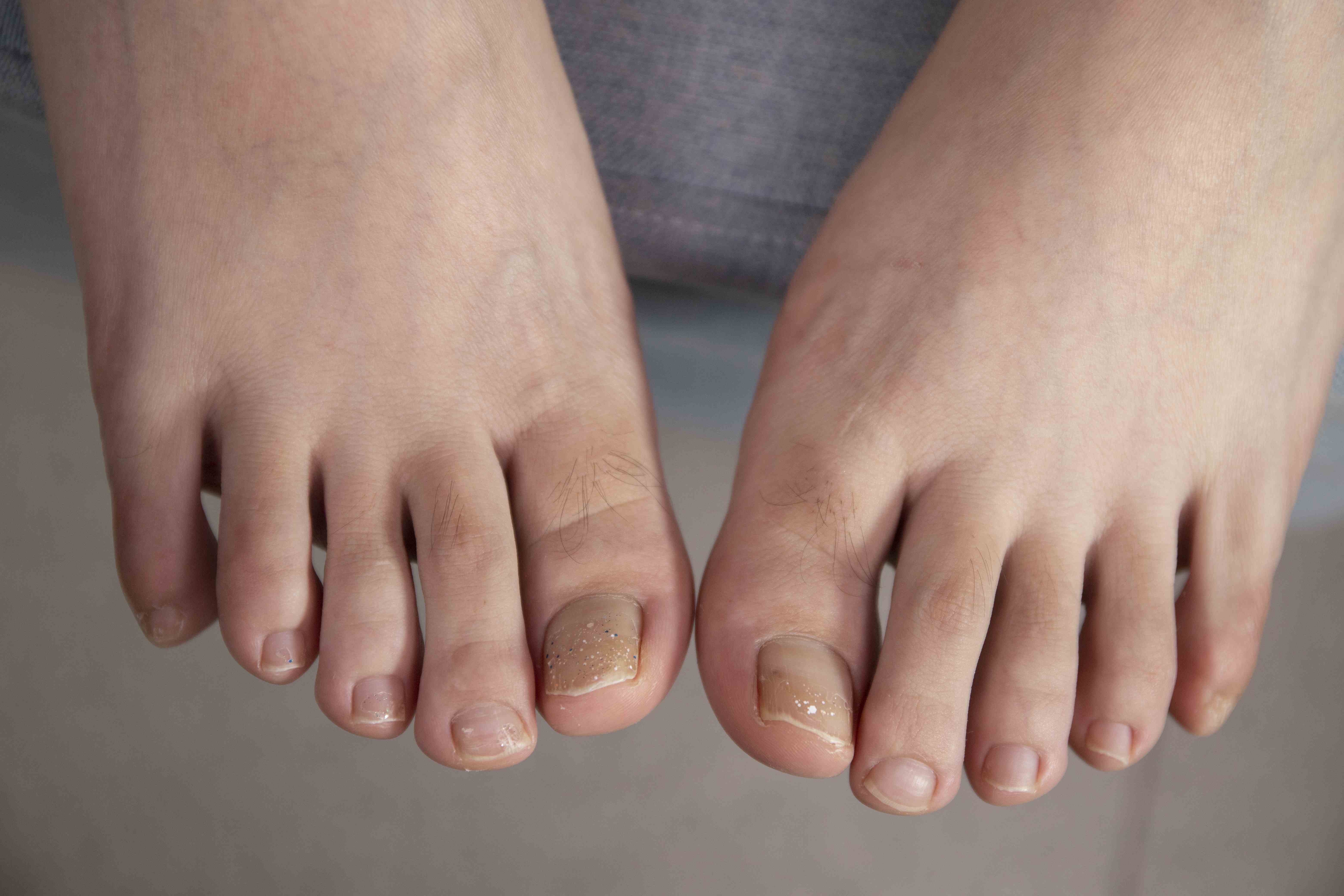 China Beauty Legs and feet 1559