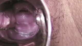 observe interesting reactions of the female genitalia